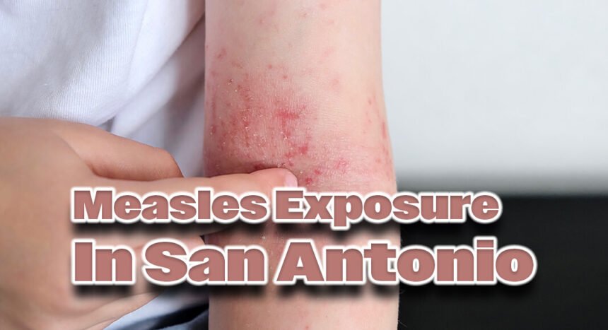 1740504675 Measles Sa.jpg